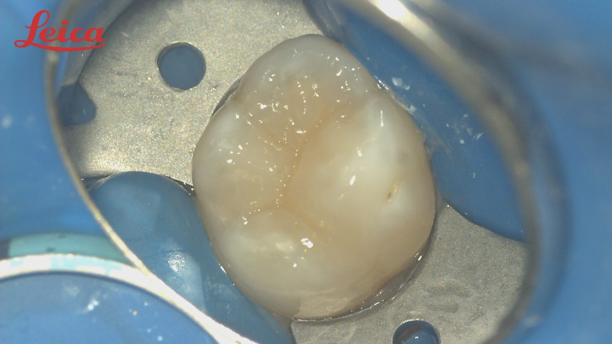 Endo 3