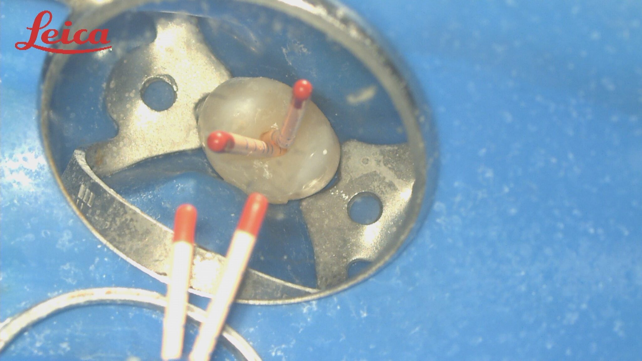 Endodoncja małoinwazyjna