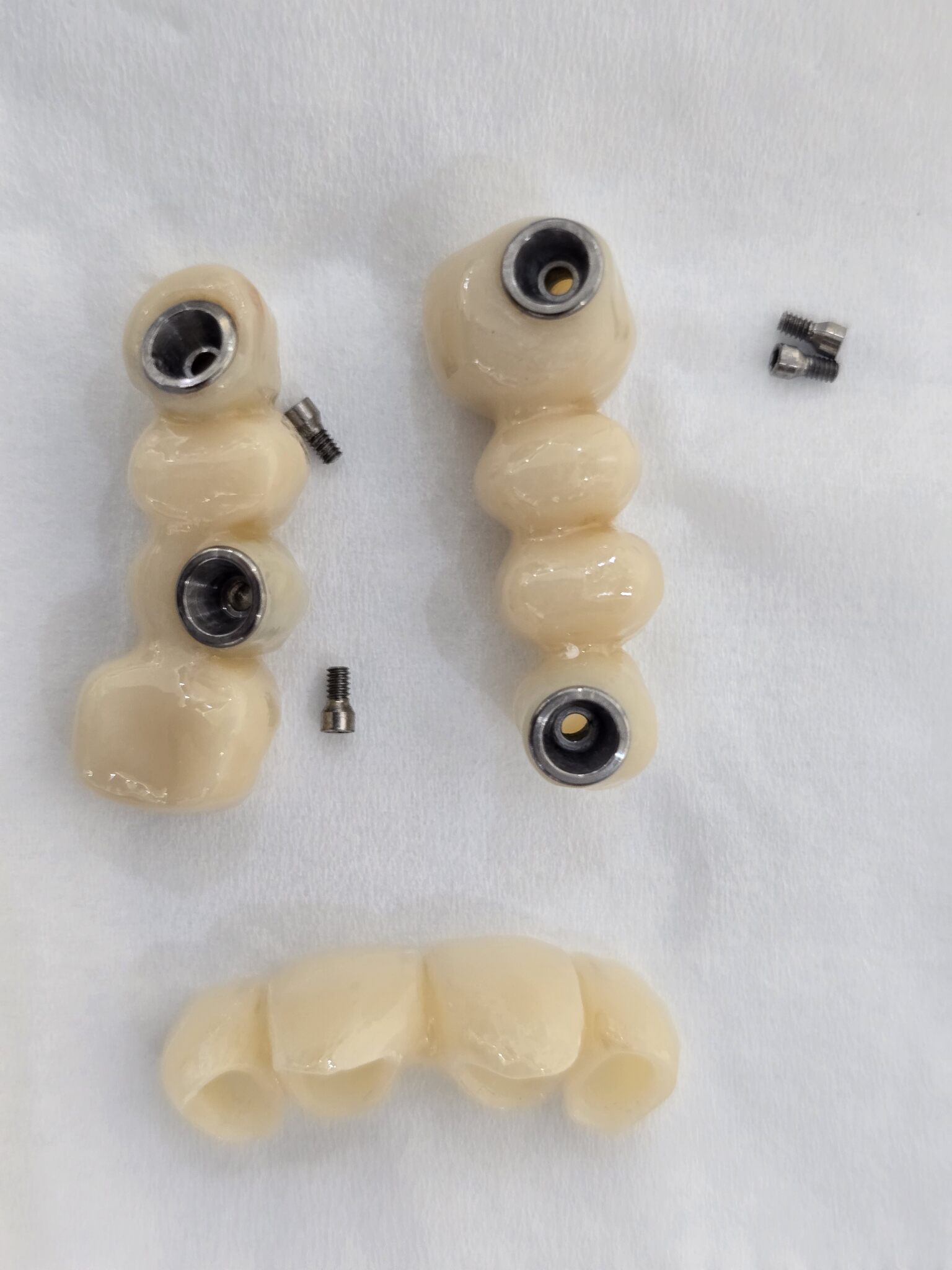 Mosty protetyczne na implantach